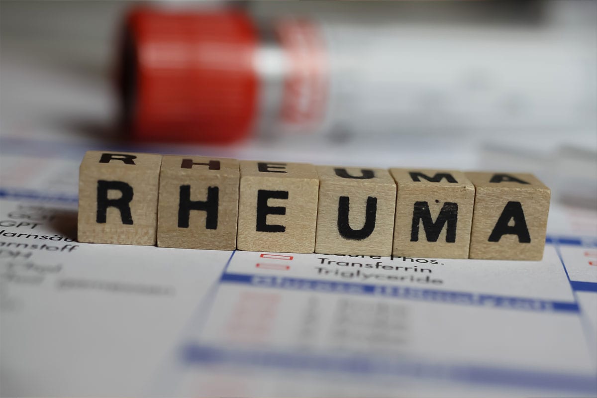 Rheuma und trockene Augen